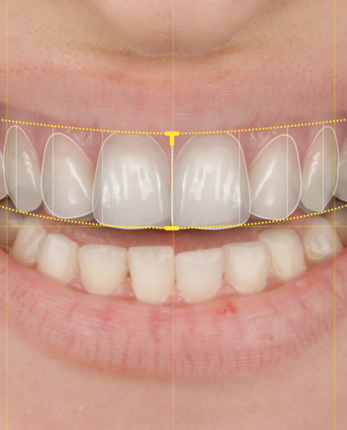 Perfect Smile