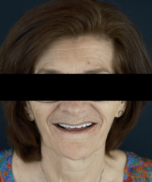 senior woman smilling